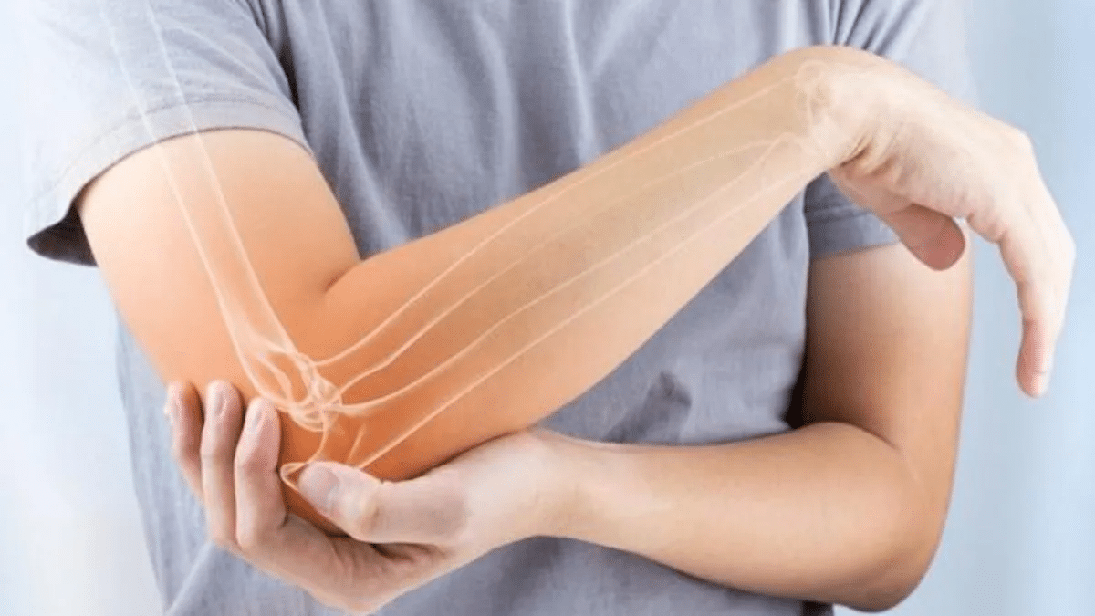 Bảo vệ khuỷu tay, giảm đau khi chấn thương do hiện tượng Tennis Elbow-2