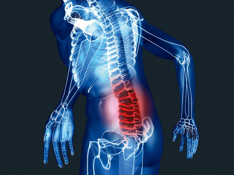 Đau vùng thắt lưng dưới xuất phát từ các chấn thương khi chơi thể thao
