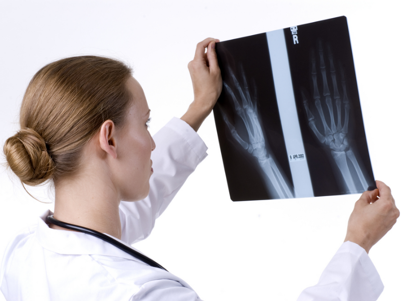 Hiện tượng đau cổ tay khi mang thai và sau sinh cảnh báo bệnh gì? 4