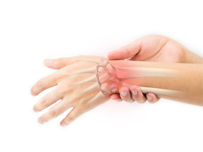Điều trị hội chứng ống cổ tay như thế nào? 2