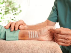 Tại sao đau cổ tay lâu ngày không khỏi? Nguyên nhân, triệu chứng và cách điều trị