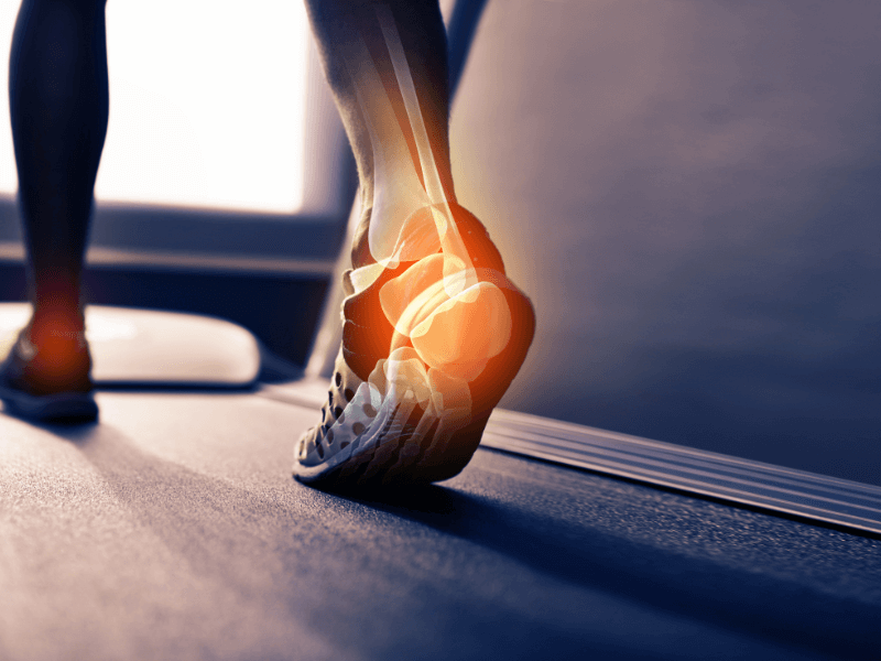 Triệu chứng và biểu hiện của bệnh dây chằng cổ chân