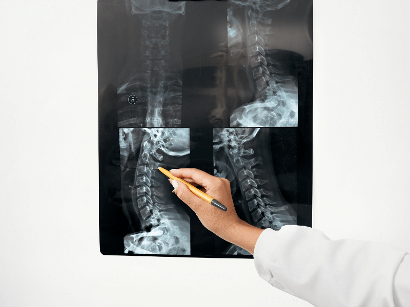 x-ray cột sống