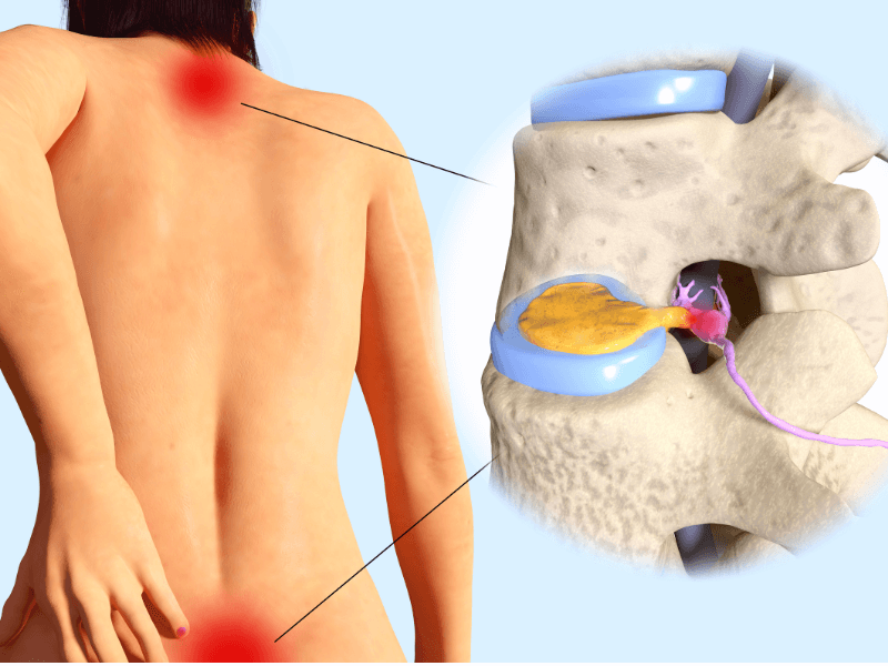 Giải phẫu học về vùng lưng: Khám phá cấu trúc phức tạp
