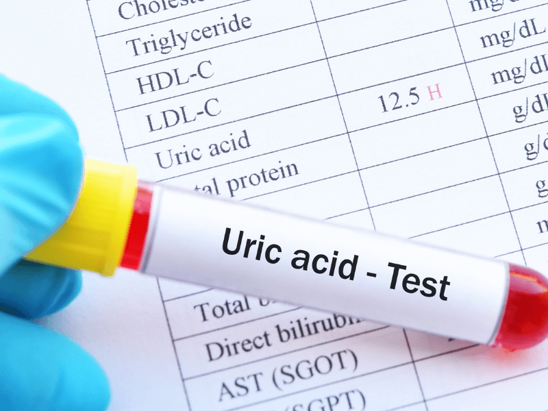 Nồng độ acid uric trong máu là gì?