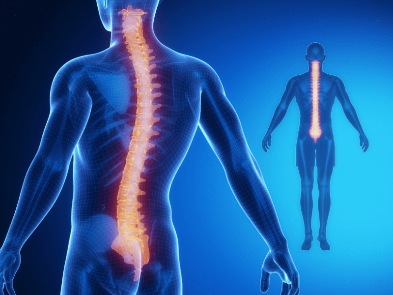 Điều chỉnh lối sống để giảm đau dây thần kinh tọa ở mông