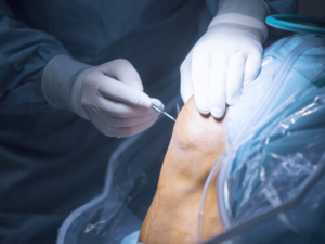 Chi phí phẫu thuật cong vẹo cột sống: Cách chữa trị hiệu quả và an toàn