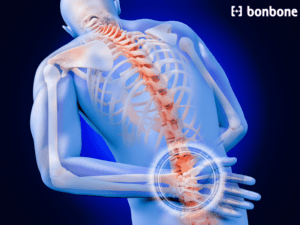 Đau lưng do thiếu canxi: Nguyên nhân và cách bổ sung