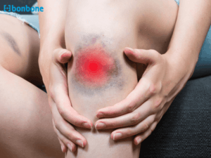 Đai khớp gối cho người cần tập phục hồi