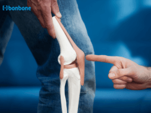 Đai khớp gối hỗ trợ giảm đau sau phẫu thuật khớp: Hành trang cho sự phục hồi