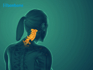 Đau cổ khi ngủ dậy và mối liên hệ với thoái hóa đốt sống cổ