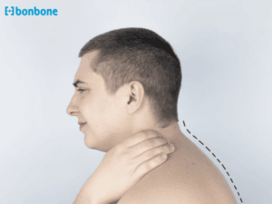 Khòm lưng có chữa được không? Giải đáp chi tiết và giải pháp hiệu quả