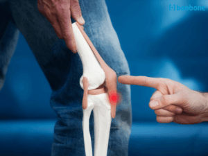 Thực phẩm chức năng bổ sung glucosamine có thực sự tốt cho sụn khớp? Giải đáp từ chuyên gia