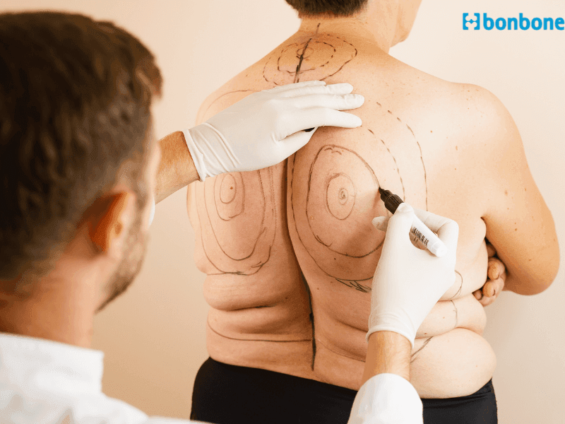 Mẹo làm thẳng lưng tôm trong 1 tháng