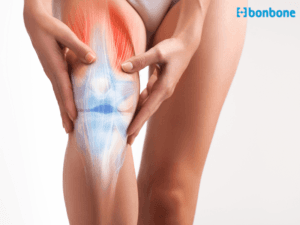 Phục hồi sau chấn thương đầu gối do chạy bộ: Hành trình từ chuyên gia cơ xương khớp