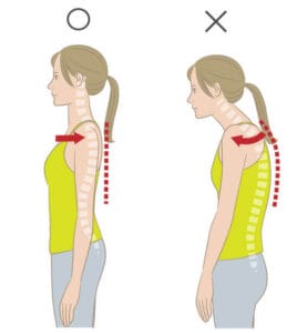 Những dấu hiệu trẻ cần đeo đai chống gù lưng – Bố mẹ cần biết để bảo vệ dáng đứng cho con